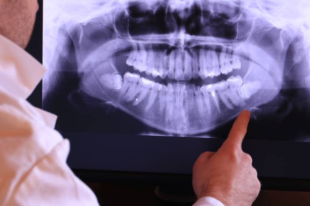 Best Emergency Denture Repair in Vinton, TX